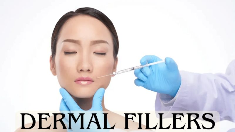 Dermal fillers, cosmetic treatments