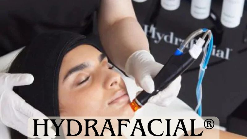 HydraFacial, cosmetic treatments