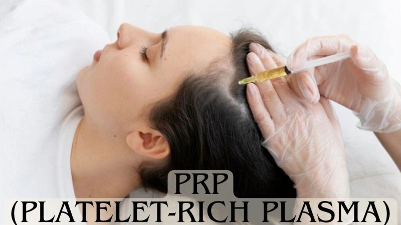 PRP, platelet-rich plasma, cosmetic treatments